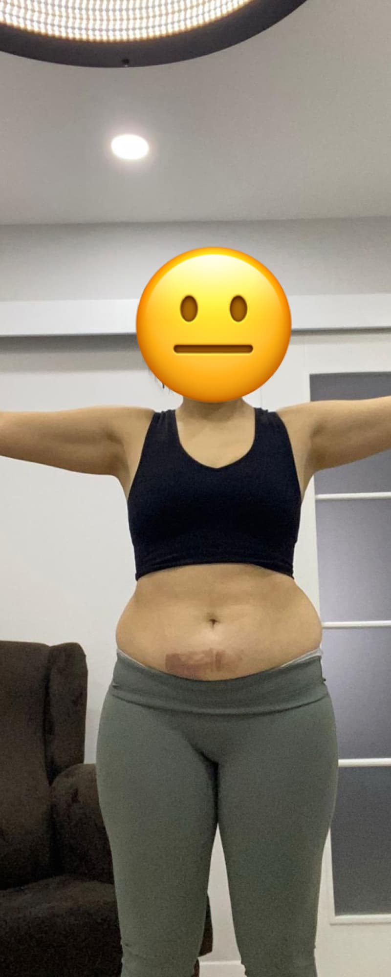 32 yaşında, bir sezeryan doğum-1