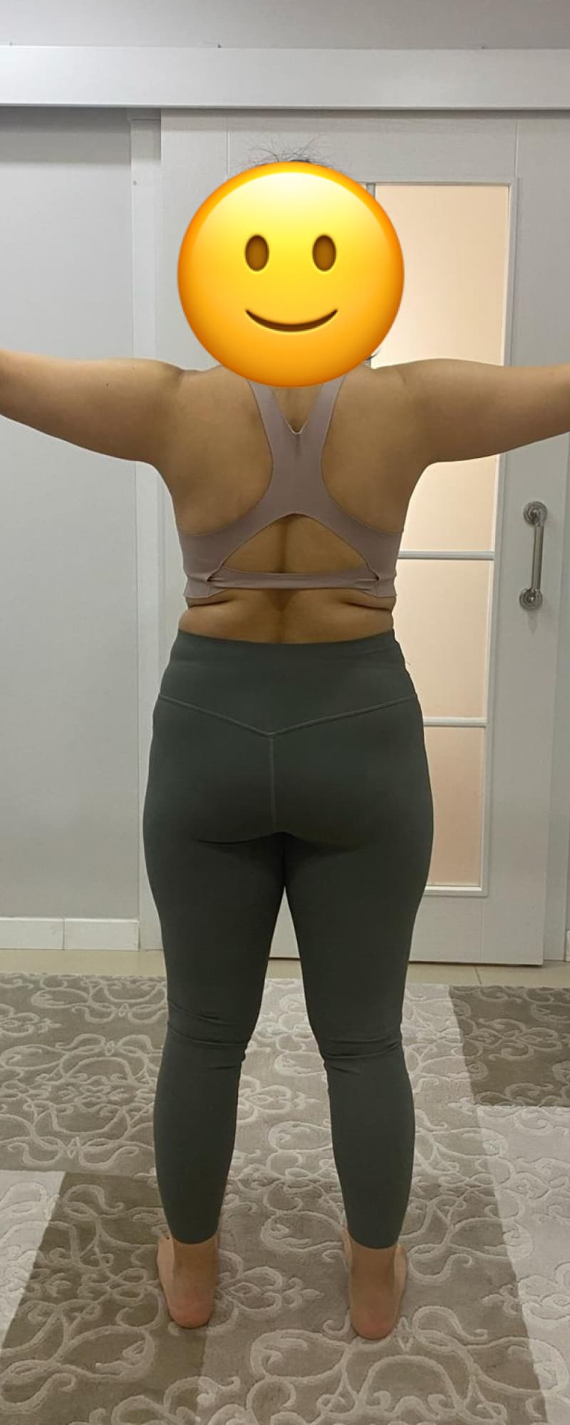 32 yaşında, bir sezeryan doğum-4